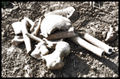 Bone Colector